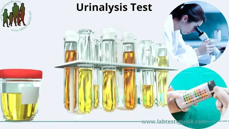 Urinalysis