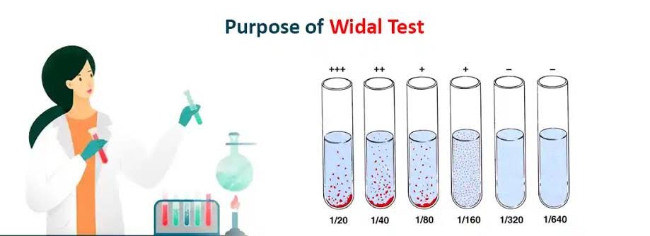 WIDAL TEST