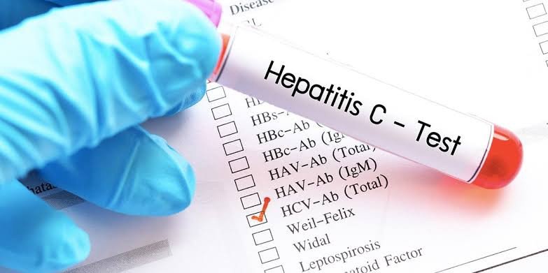 HEPATITIS C&B TEST