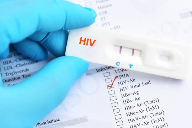 HIV TEST