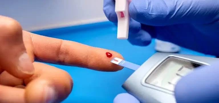 BLOOD GLUCOSE (FBG/RBG) TEST