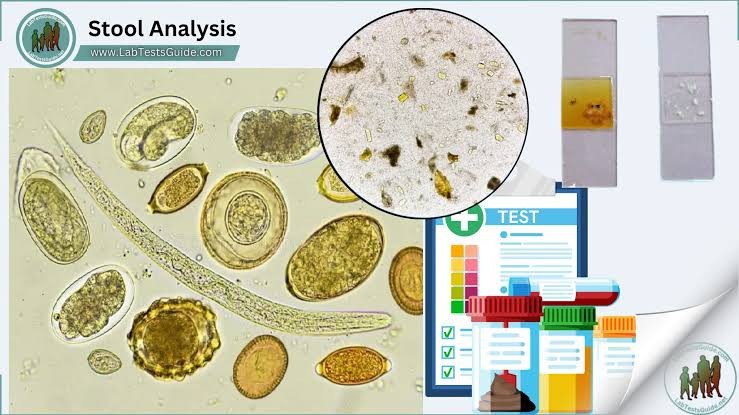 STOOL ANALYSIS ROUTINE